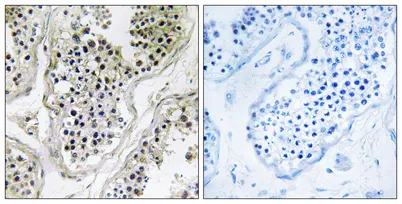 Ataxin-7L1 rabbit pAb - image 1