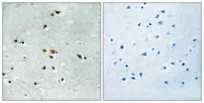 Fer (phospho Tyr402) rabbit pAb