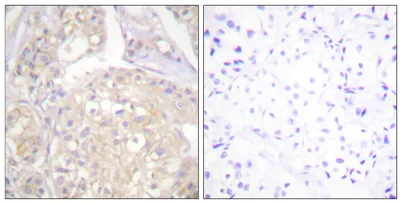 Flg (phospho Tyr766) rabbit pAb - image 1