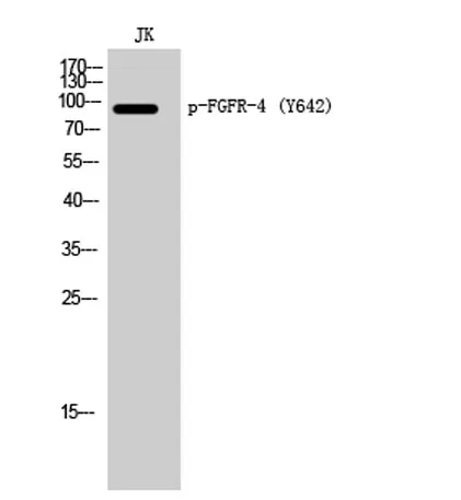 FGFR-4 (phospho Tyr642) rabbit pAb - image 1