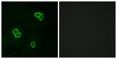 Latrophilin-1 rabbit pAb - image 1