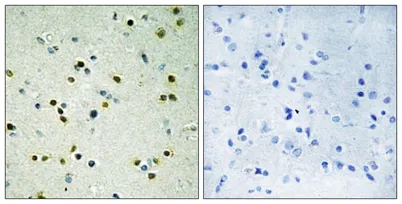 JMJD2B rabbit pAb