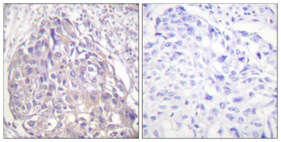 FoxO1/3/4 (phospho Thr24/32) rabbit pAb - image 1