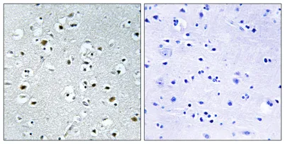 PRC rabbit pAb