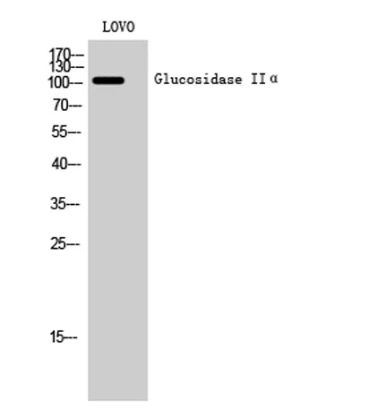 Glucosidase IIα rabbit pAb - image 1