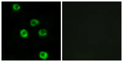 Latrophilin-2 rabbit pAb - image 1