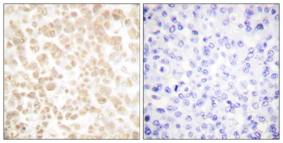 FOSL2 rabbit pAb - image 1
