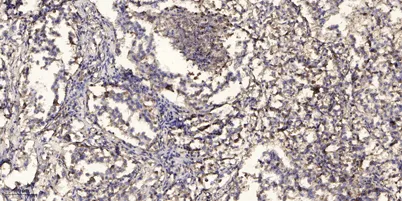 ACOT9 rabbit pAb - image 1