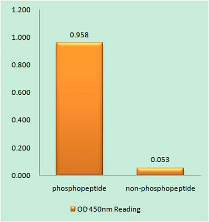 ALK (phospho Tyr1096) rabbit pAb