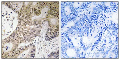 PRP6 rabbit pAb