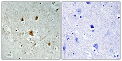 Abl1 (phospho Tyr204) rabbit pAb - image 1