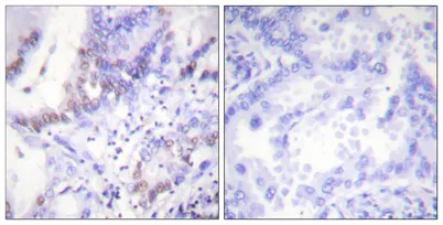 Abl1/2 (phospho Tyr393/439) rabbit pAb