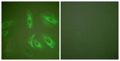 Gastrin rabbit pAb