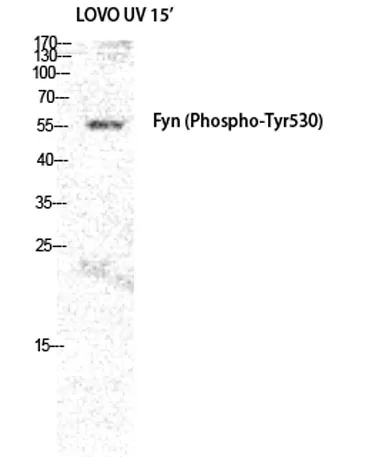 Fyn (phospho Tyr530) rabbit pAb - image 1