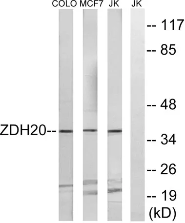 ZDHHC20 rabbit pAb - image 1