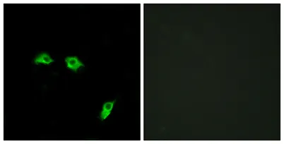 GABAB R1 rabbit pAb - image 1