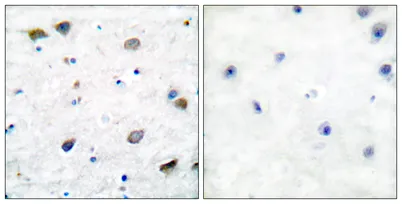 GABAA Rβ1 rabbit pAb - image 1