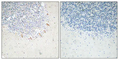 GABAA Rβ2 rabbit pAb - image 1