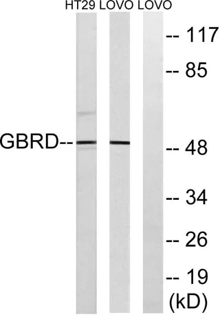 GABAA Rδ rabbit pAb - image 1