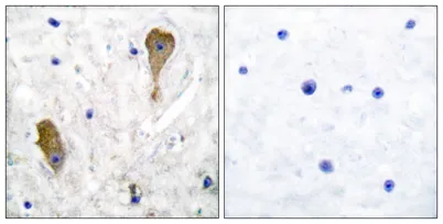 GAD67 rabbit pAb - image 1