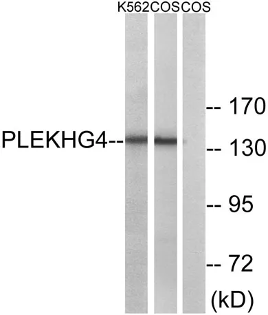 Puratrophin 1 rabbit pAb