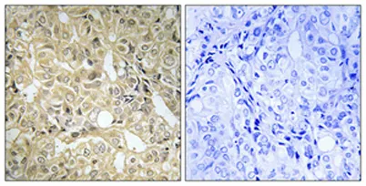 DHA Kinase rabbit pAb - image 1