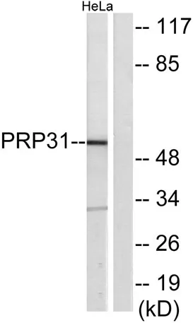 PRPF31 rabbit pAb