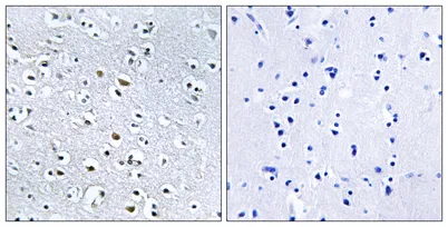 Nephrocystin-4 rabbit pAb - image 1