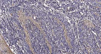PTP22 rabbit pAb