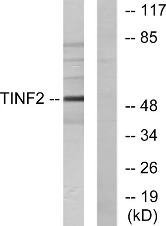 TIN2 rabbit pAb - image 1