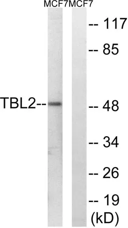 TBL2 rabbit pAb