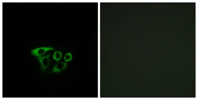 ATP5L2 rabbit pAb