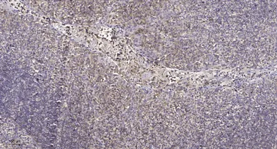 β-1,4-Gal-T1 rabbit pAb - image 1