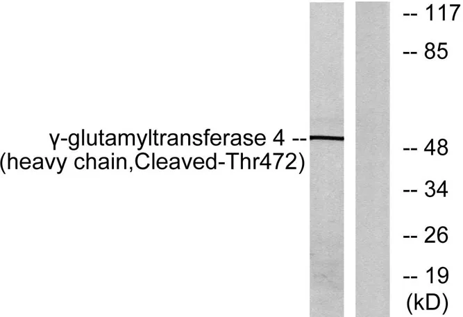 Cleaved-GGT4 HC (T472) rabbit pAb - image 1