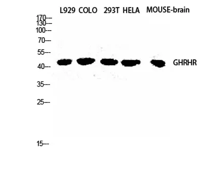 GHRH-R rabbit pAb - image 1