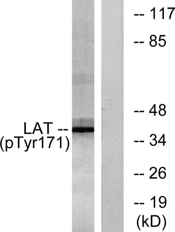 LAT (phospho Tyr200) rabbit pAb - image 1