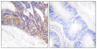 LAT (phospho Tyr191) rabbit pAb - image 1