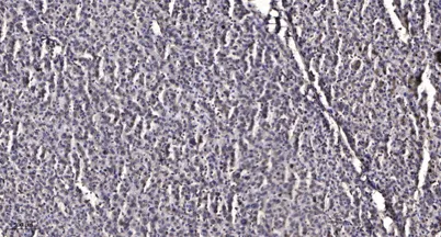 INPP5J rabbit pAb - image 1