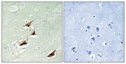 Pdcd-4 (phospho Ser67) rabbit pAb - image 1