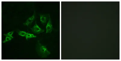 GnRH-R rabbit pAb - image 1