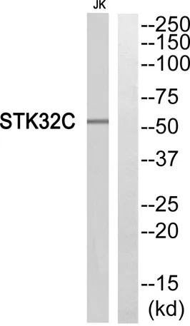STK32C rabbit pAb - image 1