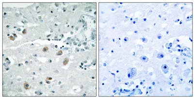 cPLA2-δ rabbit pAb - image 1