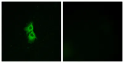GPR22 rabbit pAb - image 1