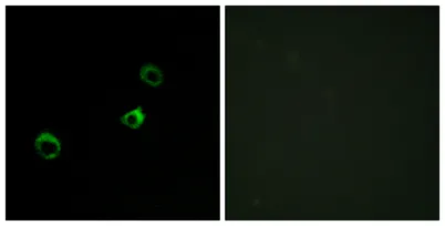 CYB561D1 rabbit pAb
