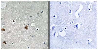 CSN1 (phospho Ser454) rabbit pAb - image 1
