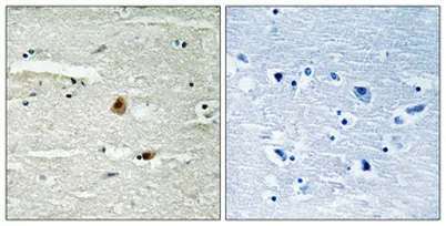 CSN1 rabbit pAb - image 1