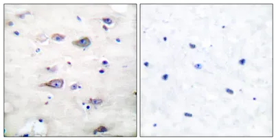 GluR-2 (phospho Ser880) rabbit pAb - image 1