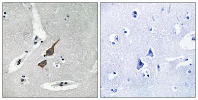 GluR-δ1 rabbit pAb - image 1