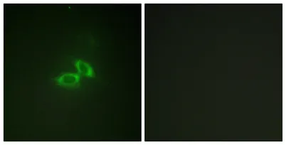 NMDAζ1 rabbit pAb