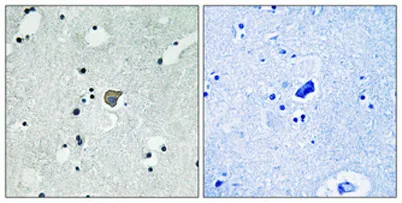 NMDAε1/2 (phospho Tyr1246/1252) rabbit pAb - image 1